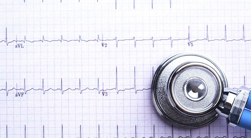 Electrocardiograma